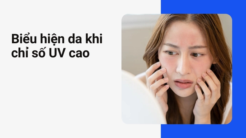 Làn da bị ửng đỏ và tổn thương do tiếp xúc tia cực tím cường độ cao