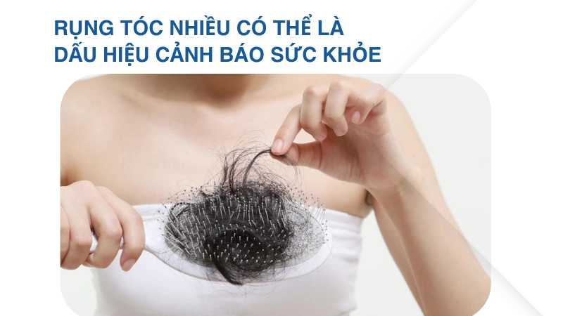 Rụng tóc nhiều cảnh báo vấn đề sức khỏe gì